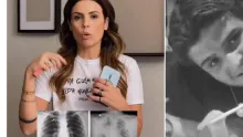 Lia Paiva publicó un video en las redes sociales y mostró una foto de sus pulmones.