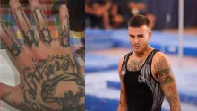 El gimnasta, que fue campeón del mundo, mostró las heridas que le dejó el hecho.