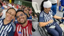 Hincha Eber Otero y su mamá que terminó con la cabeza partida.