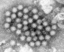 Esta imagen de microscopio electrónico facilitada por los Centros para el Control y la Prevención de Enfermedades de Estados Unidos (CDC, por sus siglas en inglés) muestra un grupo de viriones de norovirus. (Charles D. Humphrey/CDC vía AP, Archivo)