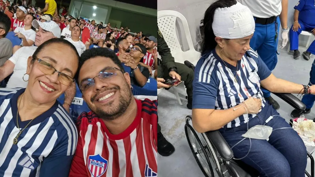 Hincha Eber Otero y su mamá que terminó con la cabeza partida.