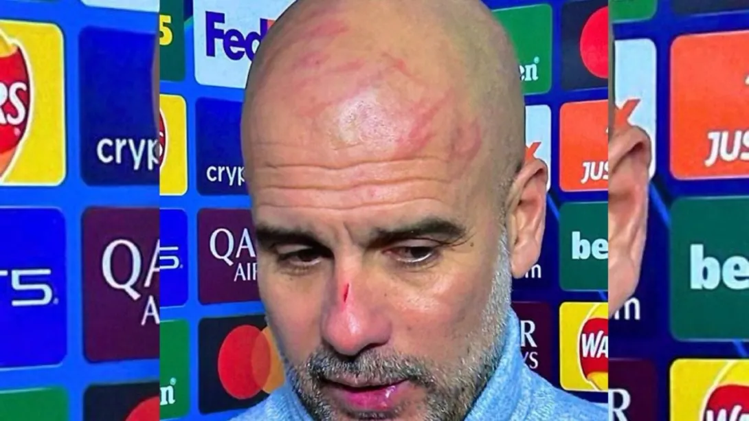 Guardiola habló de sus heridas.